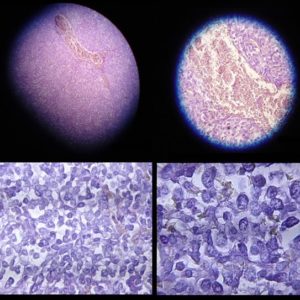 Mesothelioma Lawyers - The Top U.S. Asbestos Attorneys, personal injury, personal injury lawyer, accident lawyer, accident attorney, knoxville accident lawyer, knoxville accident attorney, car accident attorney, car accident lawyer